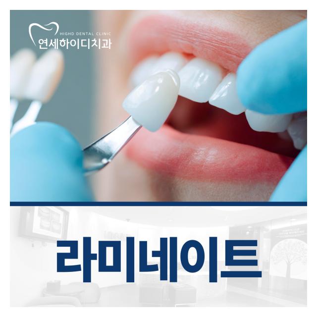 라미네이트 환하고 아름다운 미소를 가져보세요