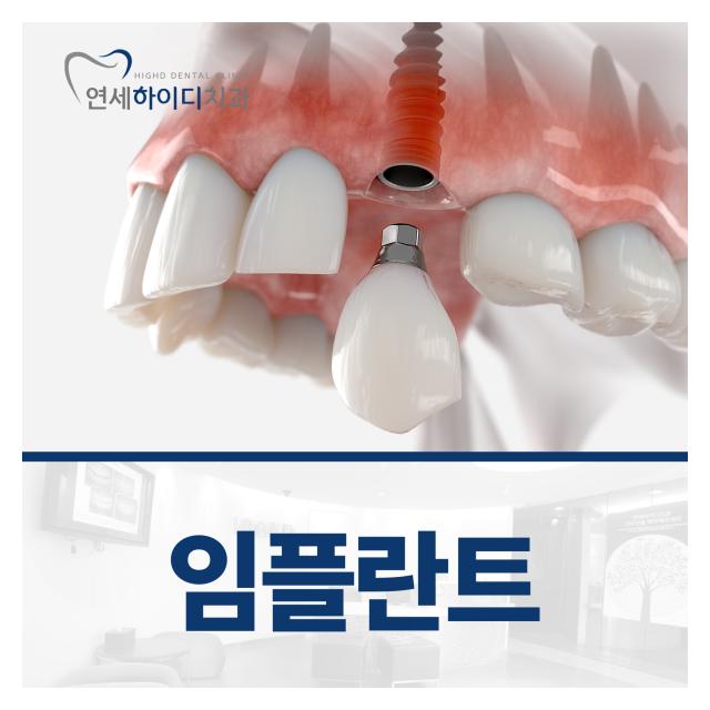 3D 디지털 장비 정밀진단 임플란트 진료