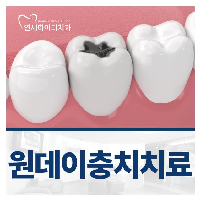 빠르고 만족스런 일상복귀 원데이 충치치료